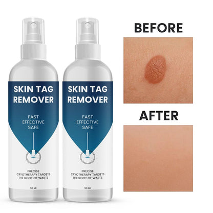 Skin Tag Remover 100 ml Pack of 2