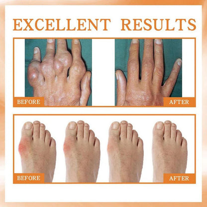 Bee Venom Beesae Arthritis Spreay 100ML